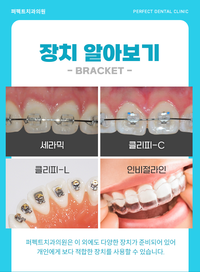 치아교정, 치료 시 참고사항은? 관련 이미지 8