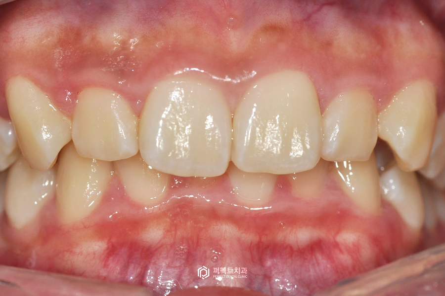 라미네이트를 하면 안되는 경우도 있다? 관련 이미지 4