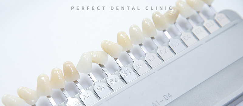전문가 치아미백 가격얼마? 관련 이미지 2