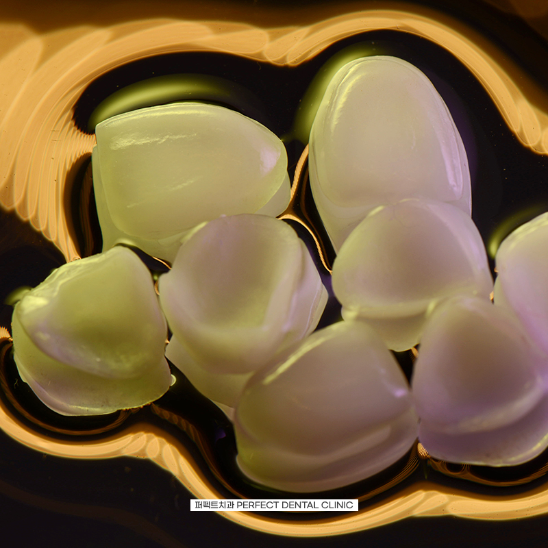 무삭제라미네이트는 어떤 문제점이? 관련 이미지 3