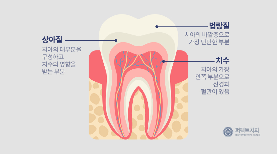 소름 돋는 시린이, 치료방법과 예방법을 알아보자 관련 이미지 3