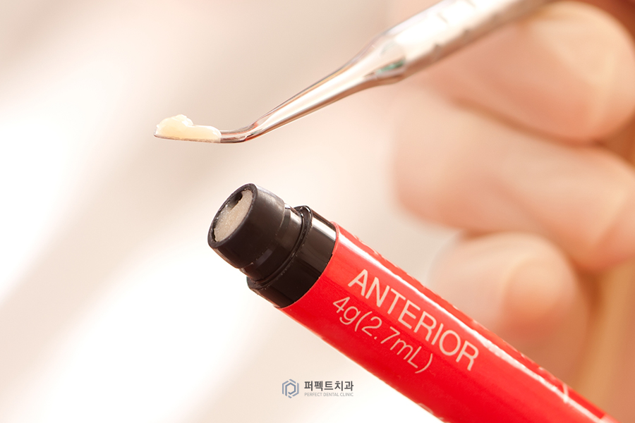 치아가 시린 이유, 치경부마모증?! 관련 이미지 3