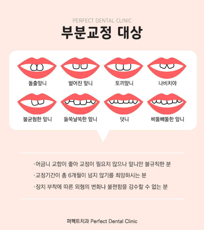 아랫니 부분교정 비용은? 관련 이미지 3