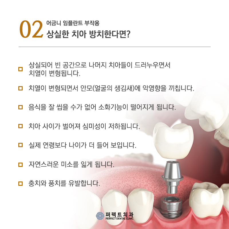 어금니 임플란트 부작용 증상 관련 이미지 4