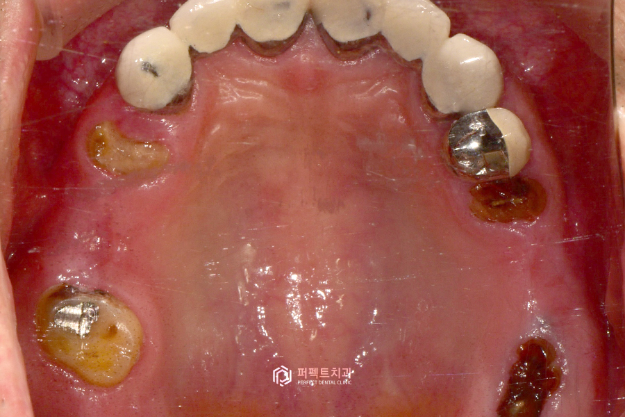 어금니가 없어 앞니로 음식을 드셨던..😰 어떻게 변했을까? 관련 이미지 3