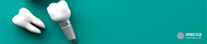 임플란트 전 고려해야 할 사항은? 관련 이미지 2