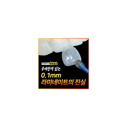 강남역치과 무삭제라미네이트 비용 관련 이미지 3
