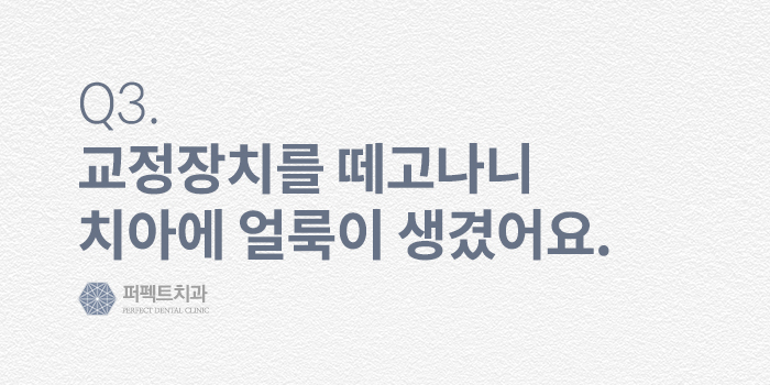 치아교정, 그 후 - 교정후부작용, 교정후관리방법 FAQ 관련 이미지 4