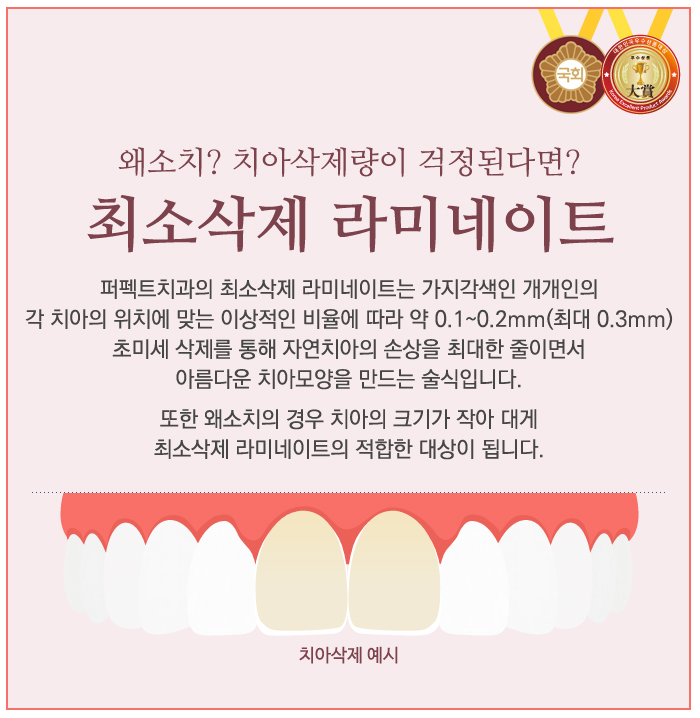 교정 후 왜소치라미네이트 시술! 관련 이미지 5