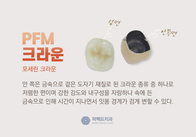 선릉역 지르코니아 크라운 비용 관련 이미지 3