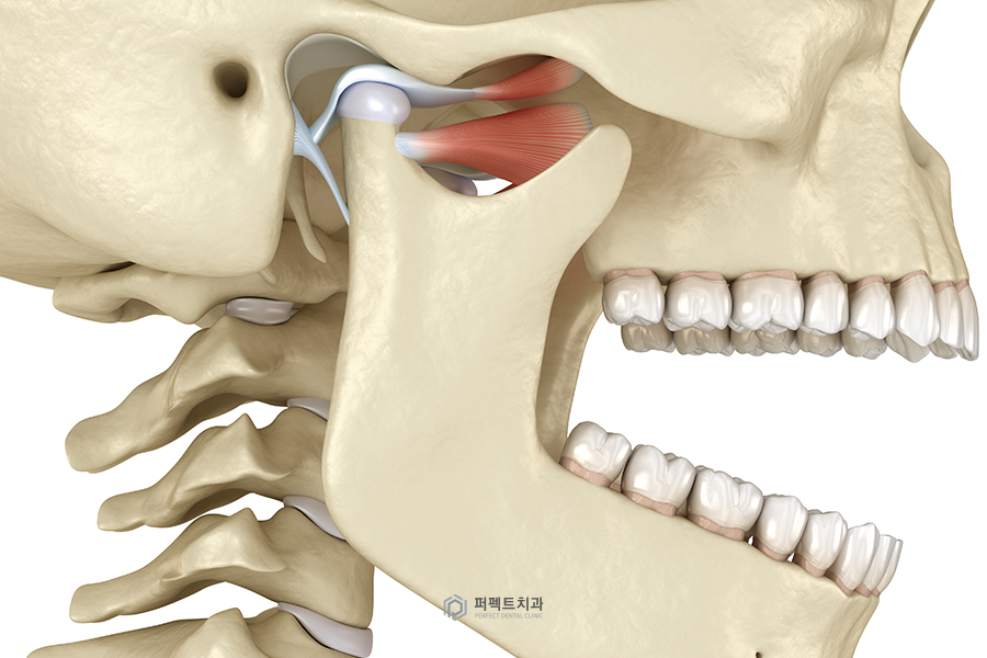 턱관절 안 좋은데 치아교정 해도 될까요? 관련 이미지 1