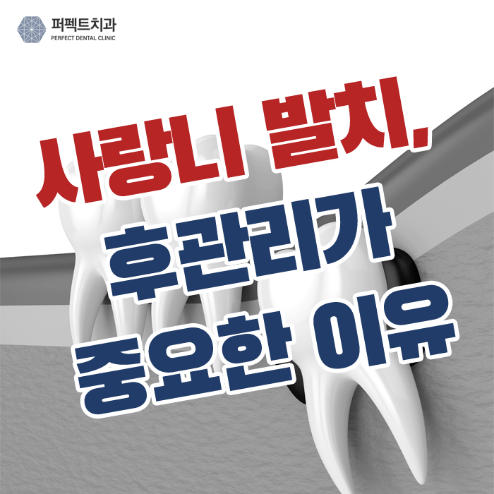 사랑니 발치 후 필요한 관리법은? 관련 이미지 1