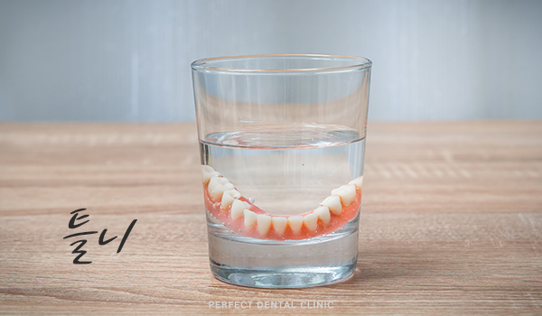 상실한 치아 어떻게 해야하나? 관련 이미지 3