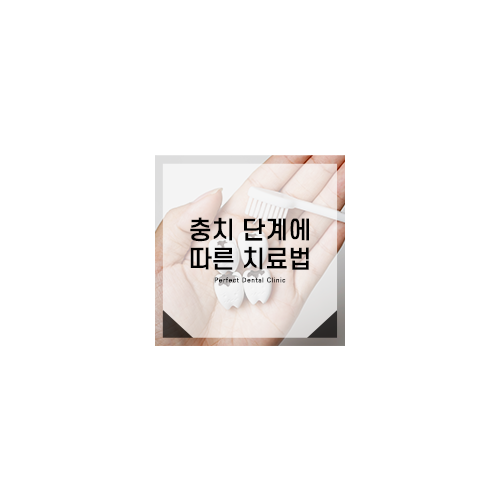 충치 단계에 따른 치료법 관련 이미지 6