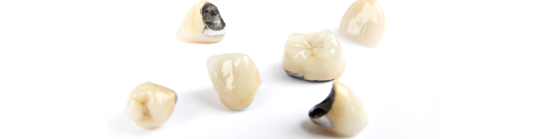 지르코니아 크라운 vs 골드크라운 vs PFM크라운 관련 이미지 2