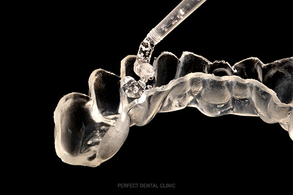 누런이가 고민? 전문가미백 받아봐! 관련 이미지 2