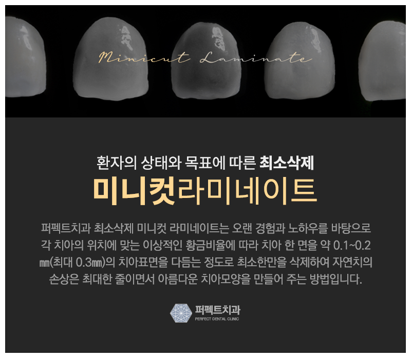 나에게 라미네이트 부작용이 생긴 이유 관련 이미지 4