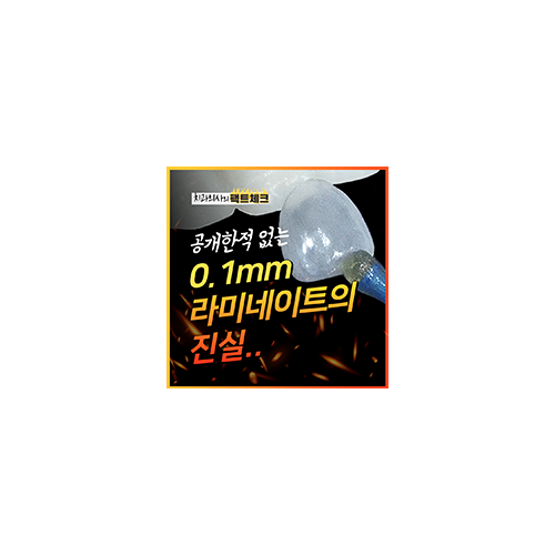 앞니 라미네이트 가격과 두께의 진실 관련 이미지 7