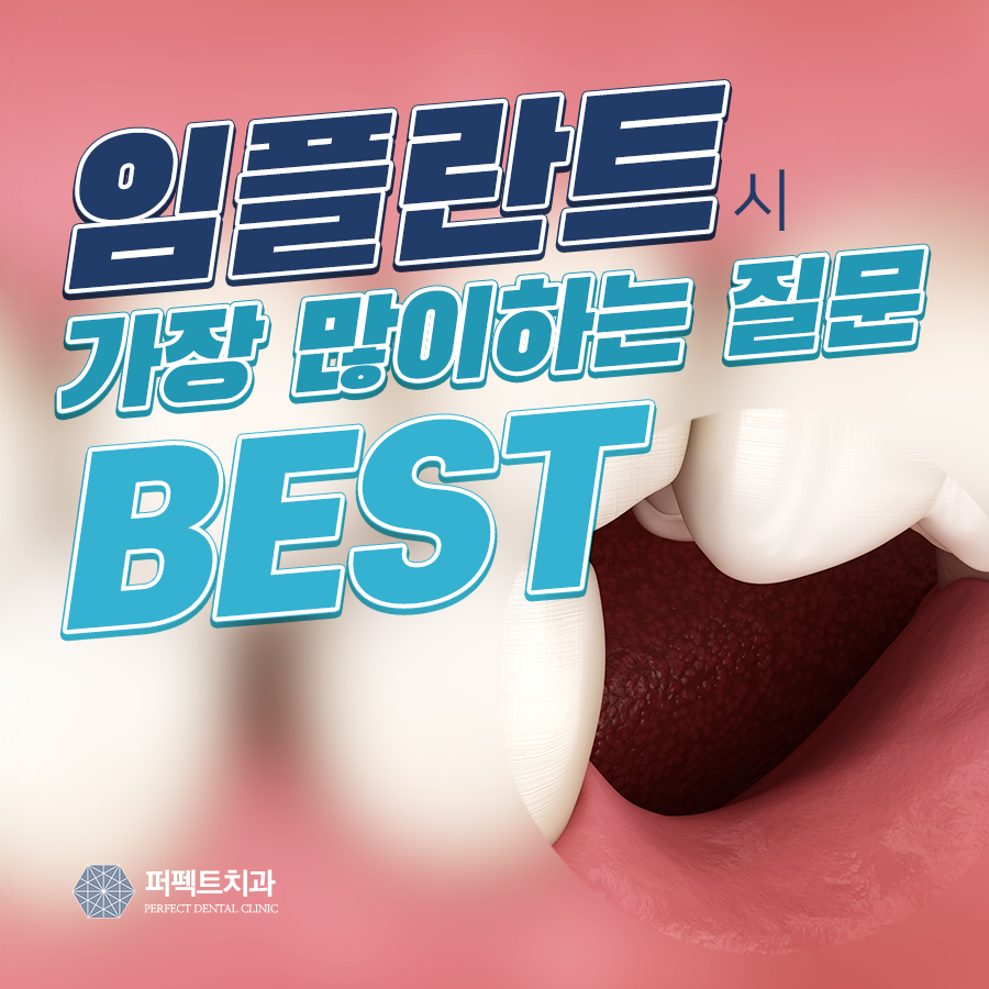 임플란트 시 가장 많이 하는 질문 Best 관련 이미지 1