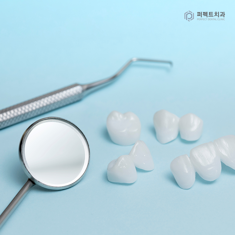 크라운 교체 시기는? 관련 이미지 2