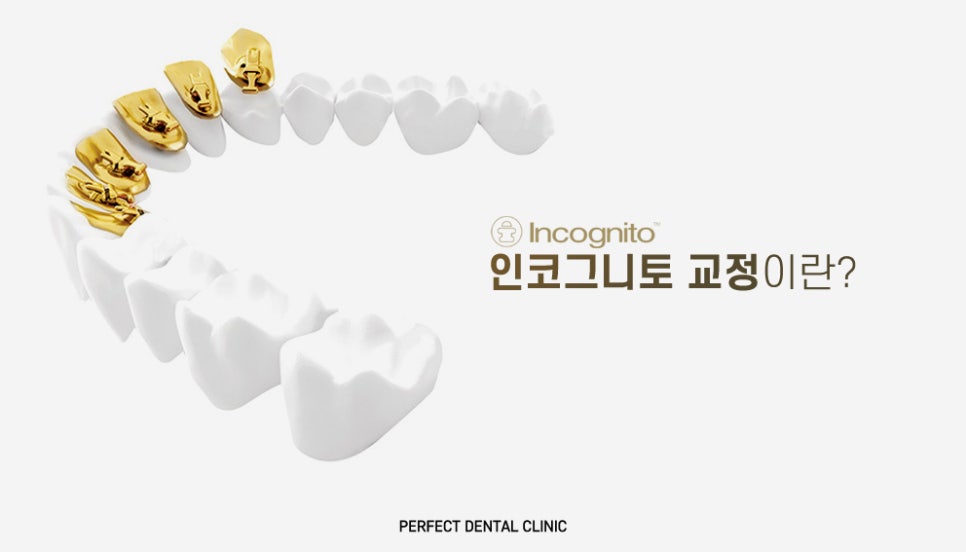 치아안쪽에 교정하는 설측교정! 관련 이미지 2