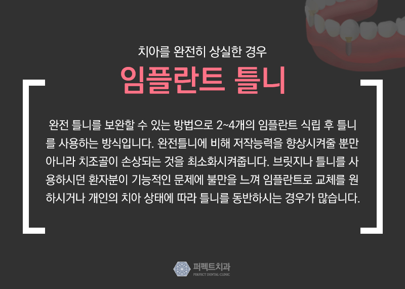 보철치료 종류와 비용 관련 이미지 7