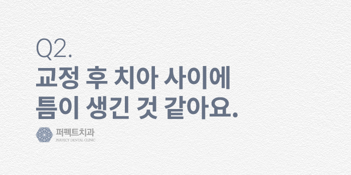치아교정, 그 후 - 교정후부작용, 교정후관리방법 FAQ 관련 이미지 3