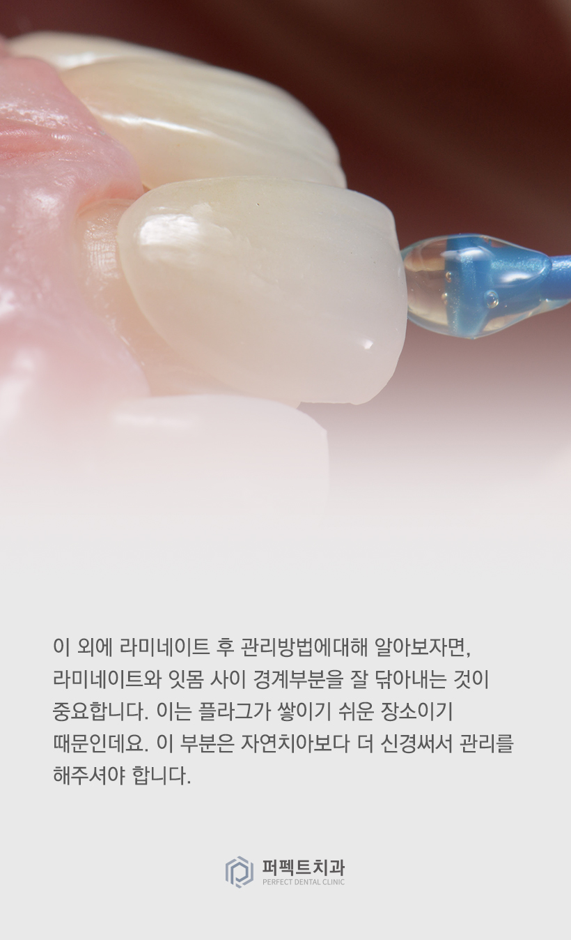 라미네이트 후 알아야 할 관리방법! 관련 이미지 2