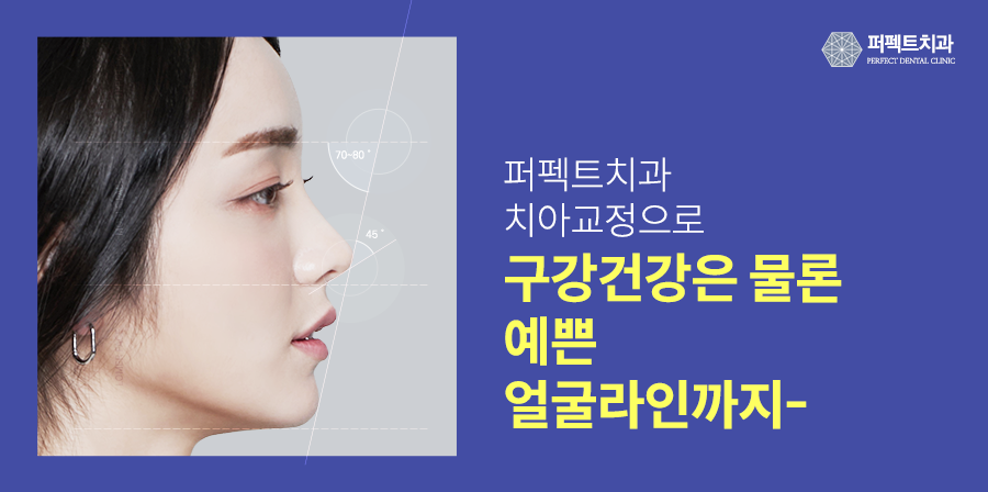 벌어진앞니교정, 원인부터 해결 방법까지 관련 이미지 9