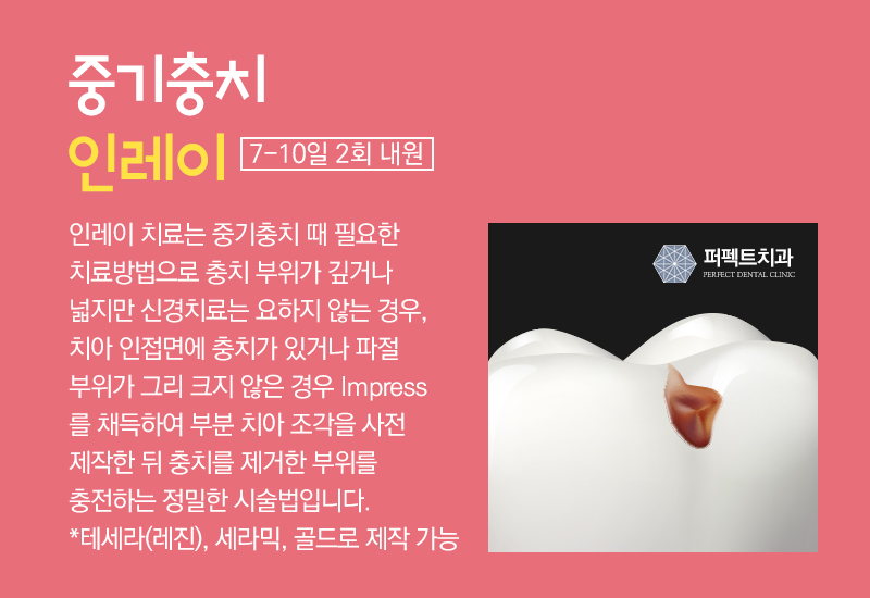 선릉 충치치료 인레이 알아보기! 관련 이미지 7