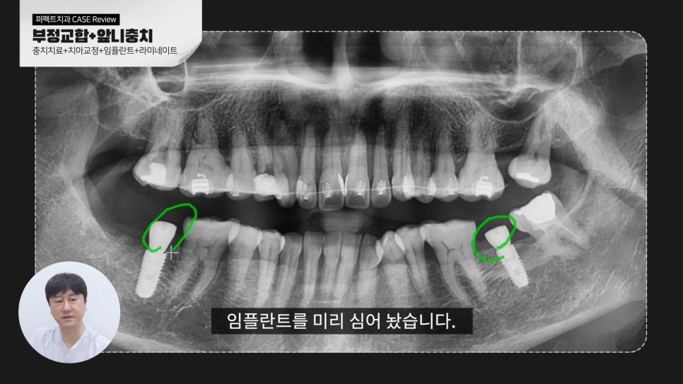 복합적인 치료가 필요한 케이스 리뷰 관련 이미지 5