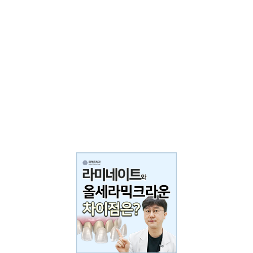 라미네이트와 올세라믹 차이점은? 관련 이미지 5