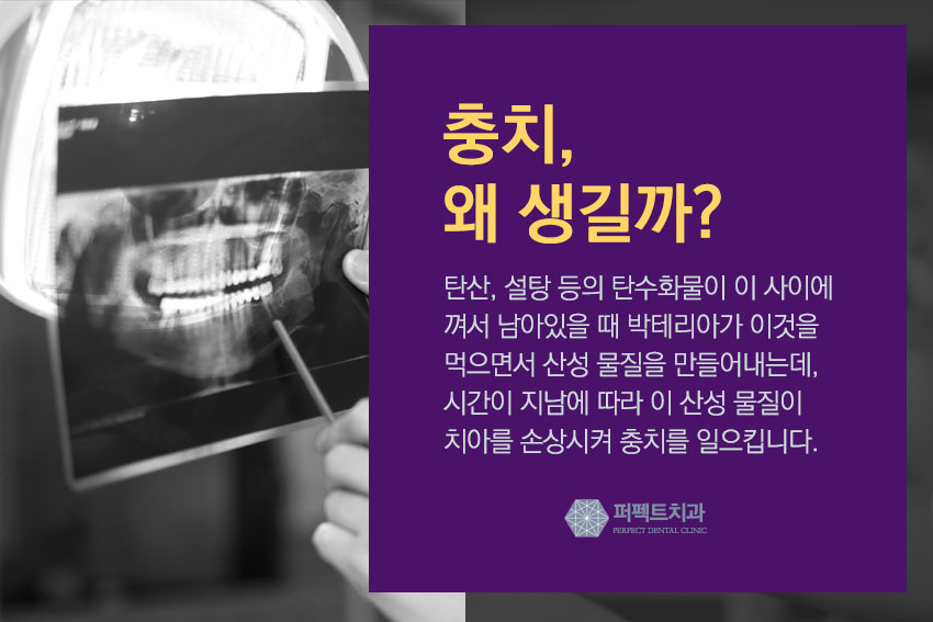 지르코니아 크라운 저렴하게 관련 이미지 4