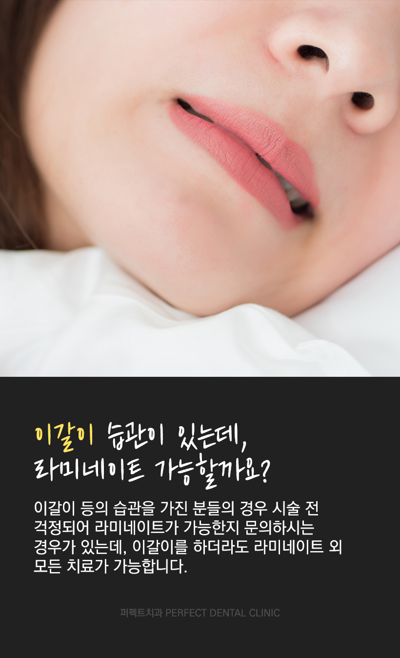 이갈이 하는데 라미네이트 가능한가요? 관련 이미지 2