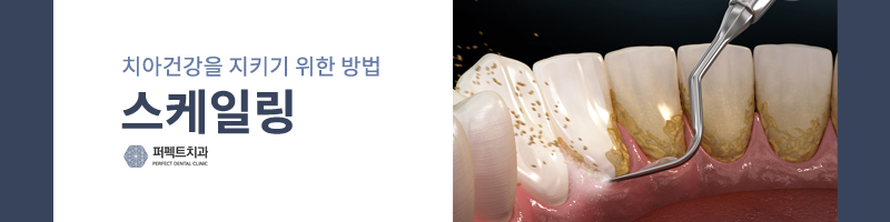 치아건강을 지키기 위해서는? 관련 이미지 3