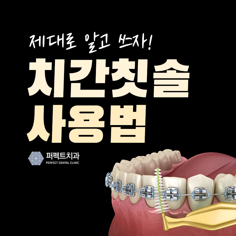 치간칫솔 사용법 제대로 알고 쓰자! 관련 이미지 1