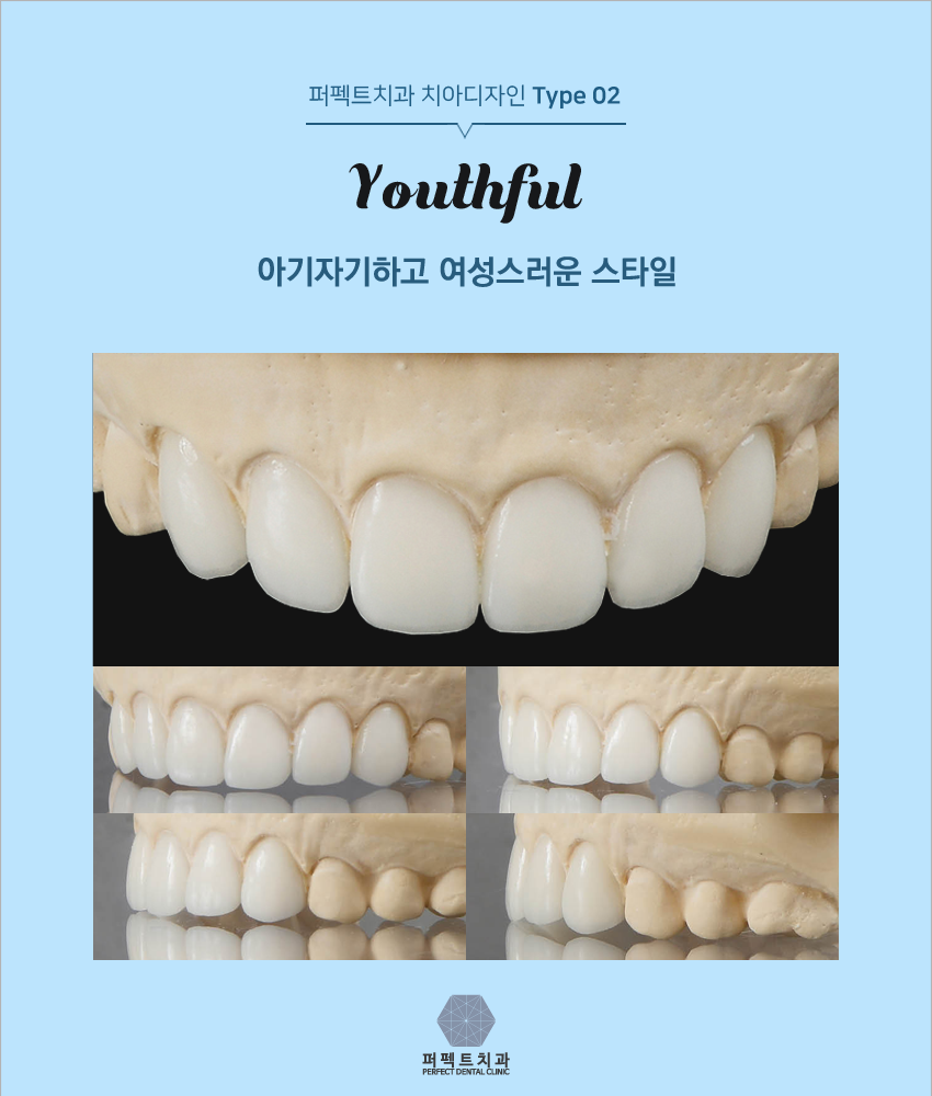 올세라믹 알아보고 있다면! 관련 이미지 6