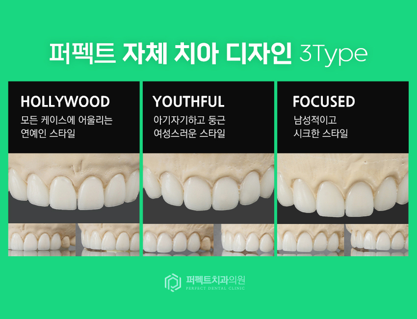 라미네이트 치료 시 참고사항은? 관련 이미지 6