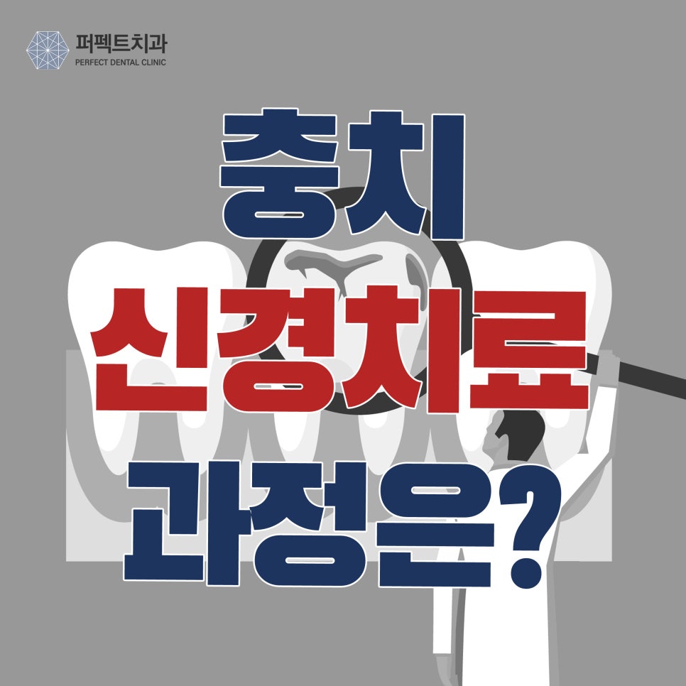 충치신경치료,  미리 알고 가세요! 관련 이미지 1