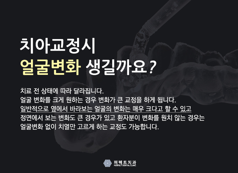 치아교정 장치종류! 관련 이미지 5