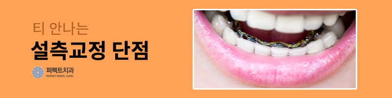 티안나는교정, 설측교정 시작! 관련 이미지 4