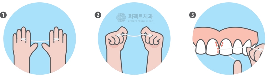 치실사용법 제대로 알고 하자! 관련 이미지 2