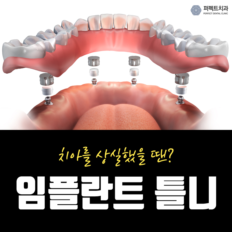 임플란트틀니 뭐가 다른가요? 관련 이미지 1