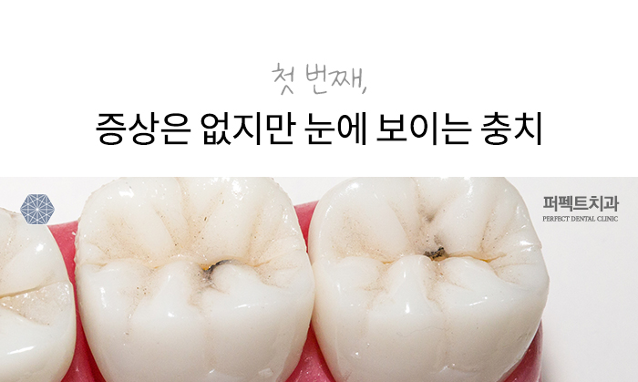 절대 무시하면 안 되는 치아증상 (치과치료꿀TIP!) 관련 이미지 2