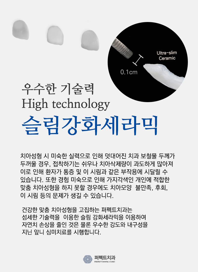 퍼펙트치치과 "0.1mm 미니컷 라미네이트" 관련 이미지 4