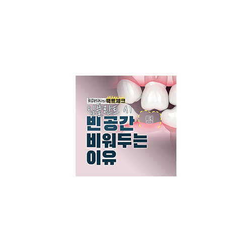 임플란트 후 빈 공간은? 관련 이미지 3