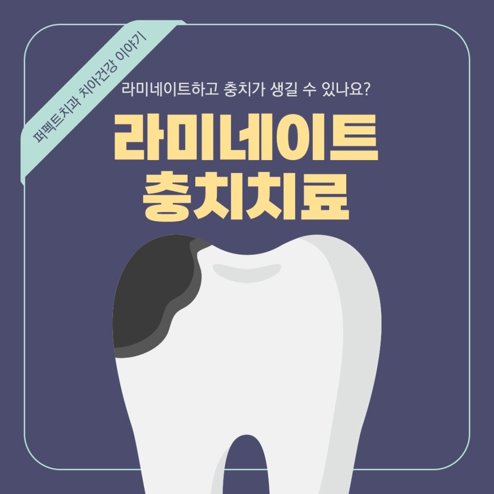 라미네이트 한 치아도 충치가 생길 수 있나요? 관련 이미지 1