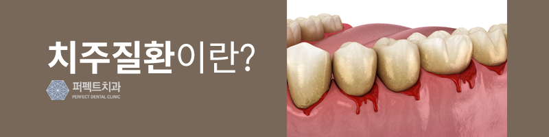 치주질환 예방법은 스케일링? 관련 이미지 2