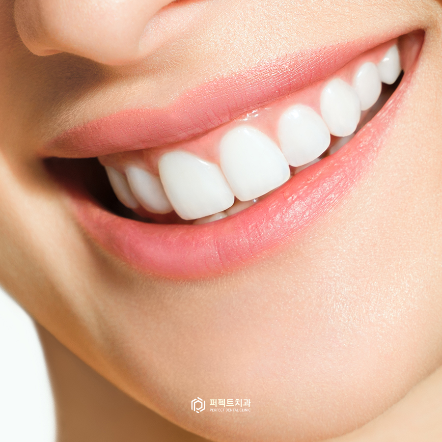 치아교정vs라미네이트, 대상은 어떻게 될까요? 관련 이미지 4