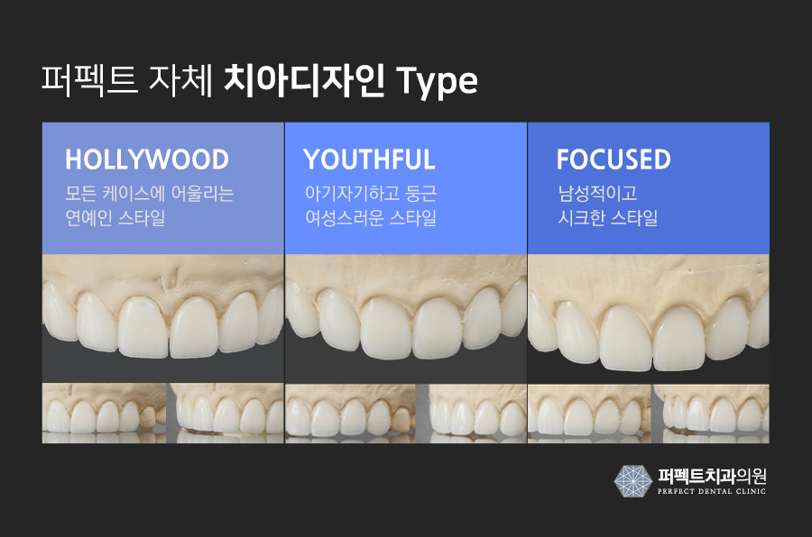 라미네이트 치료 시 참고사항은? 관련 이미지 6